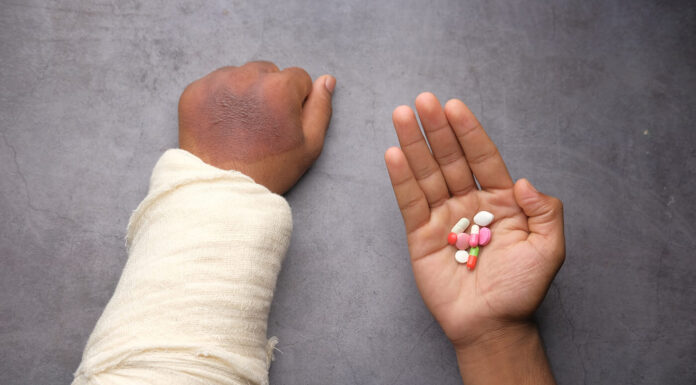 6 Life Tips For People Who Often Hurt Themselves a person who hurt himself by getting burned