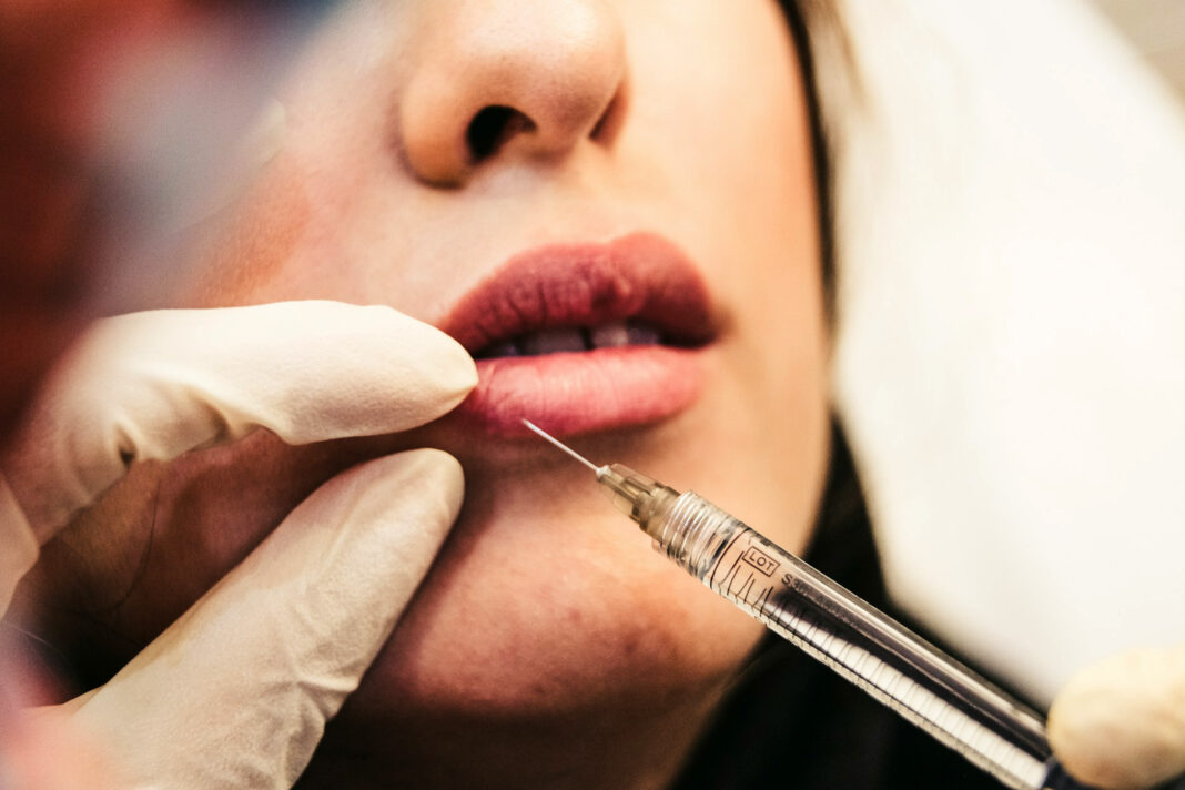 Dermal Filler in progress. Photo by Sam Moghadam-Khamseh via unsplash