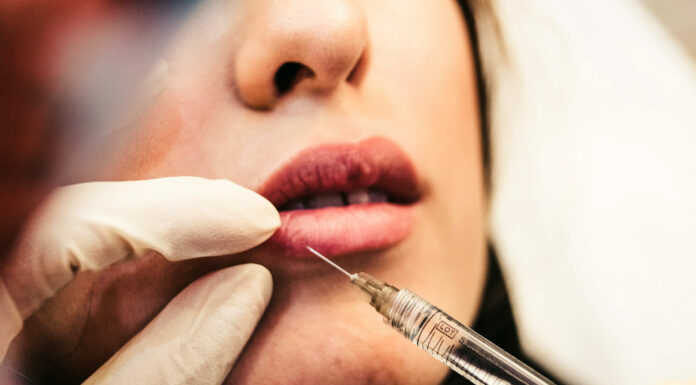 Dermal Fillers Done Right: Tips for Finding Qualified Professionals Dermal Filler in progress. Photo by Sam Moghadam-Khamseh via unsplash