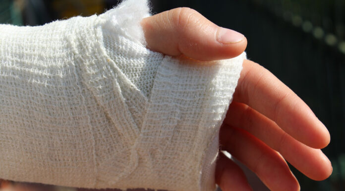 Surgery and Beyond. A Guide to Post-Operative Recovery Orthopedics after a post-operative recovery. Photo by Stefano Ferrario from pixabay