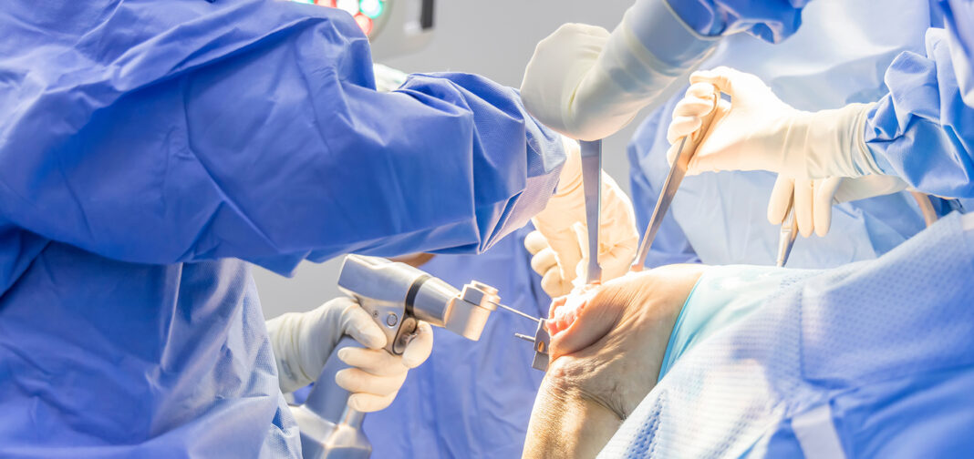 Arthrex products, orthopedic surgeon. Photo by Issara via adobe