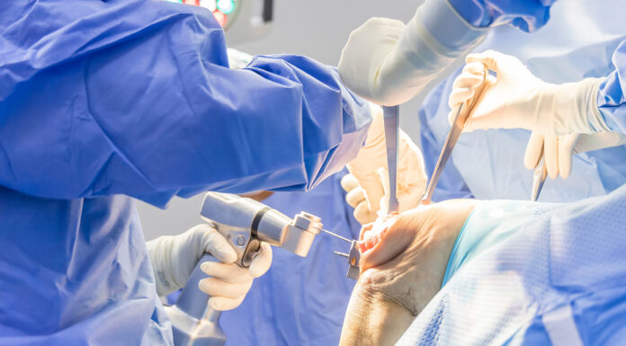 Arthrex Products: Top 14 Innovations in Orthopedic Surgery Arthrex products, orthopedic surgeon. Photo by Issara via adobe