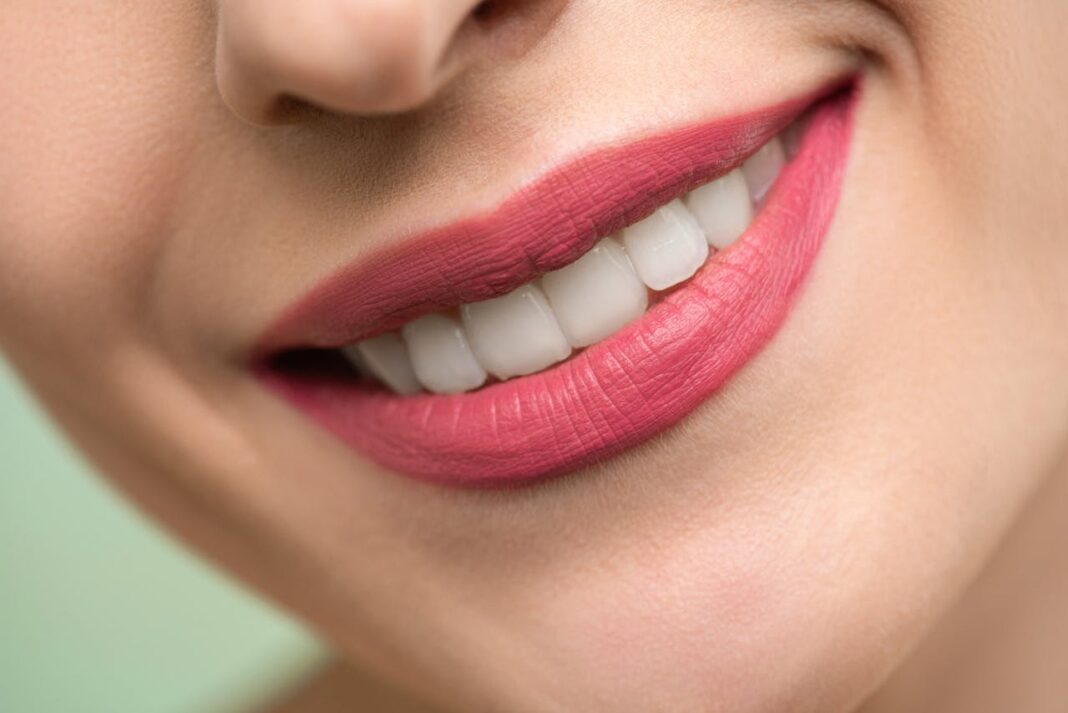 The Importance of Poor Dental Hygiene. Image via pexels by Shiny Diamond