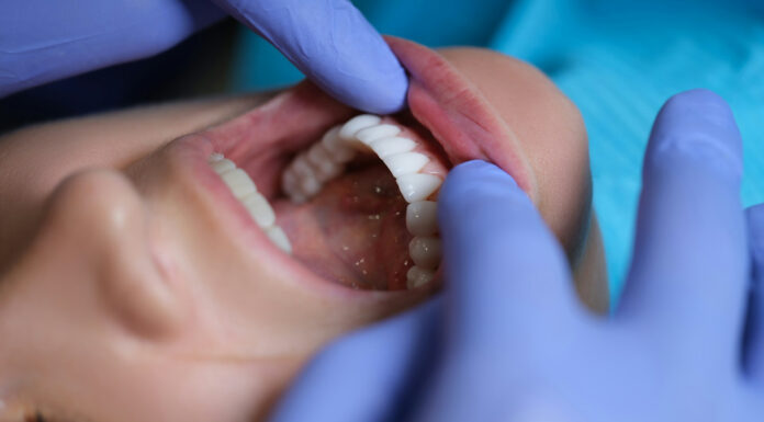 How Does Smoking Impact Dental Implant Success? Smoking Impact Dental Implant. Photo by Getty Images via unsplash