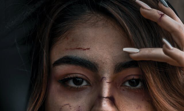 Silent Suffering After Crashes Often Starts Before Legal Help a person silently suffering after a crash. Photo by Navid Sohrabi via pexels