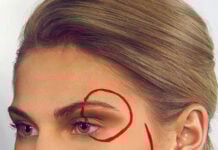 Eyebrow Lift setup for surgery. Photo by Ayo Ogunseinde via unsplash