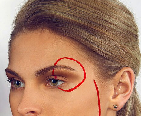 Eyebrow Lift Surgery: A Step-by-Step Guide On What to Expect Eyebrow Lift setup for surgery. Photo by Ayo Ogunseinde via unsplash