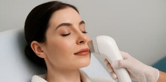 Skin tightening treatment laser