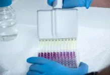 Understanding and Tackling Protein Precipitation Tackling protein precipitation. Vecteezy-medium